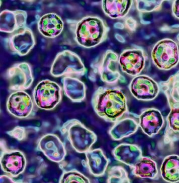 Unvaccinated Pennsylvania woman died of measles complications, coroner says unvaccinated-pennsylvania-woman-died-of-measles-complications,-coroner-says