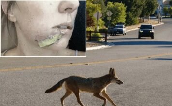 Mom Battles Fights Off Coyote with Flip-Flop After It Attacks Her Daughter mom-battles-fights-off-coyote-with-flip-flop-after-it-attacks-her-daughter