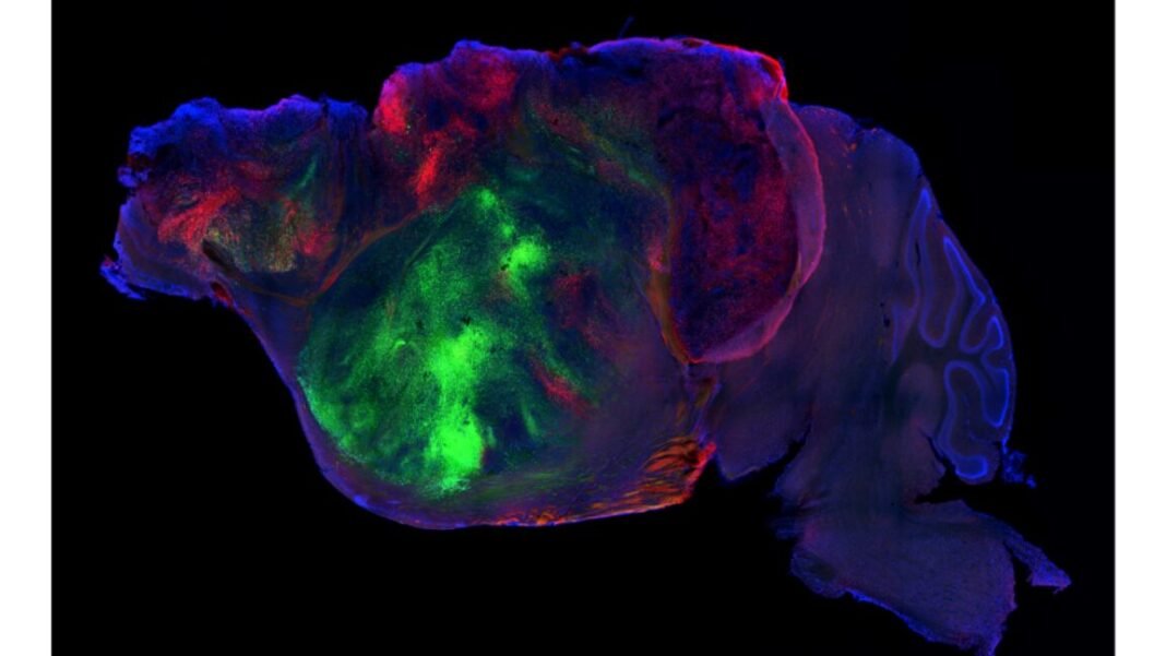 researchers-swap-in-human-brain-cells-for-a-mouse’s-cortex researchers-swap-in-human-brain-cells-for-a-mouse’s-cortex
