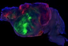 Researchers swap in human brain cells for a mouse’s cortex researchers-swap-in-human-brain-cells-for-a-mouse’s-cortex