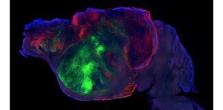 researchers-swap-in-human-brain-cells-for-a-mouse’s-cortex